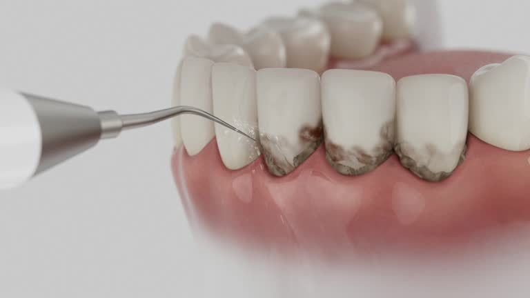 Reliable Tooth Extraction contractor in Benton County County, MO by Dentist Open Now